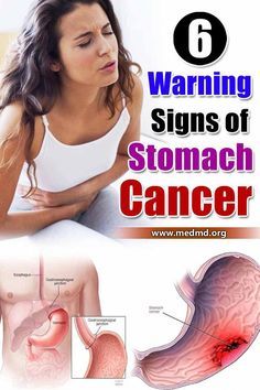 STOMACH CANCER A SILENT KILLER: Here Are The Signs & Symptoms