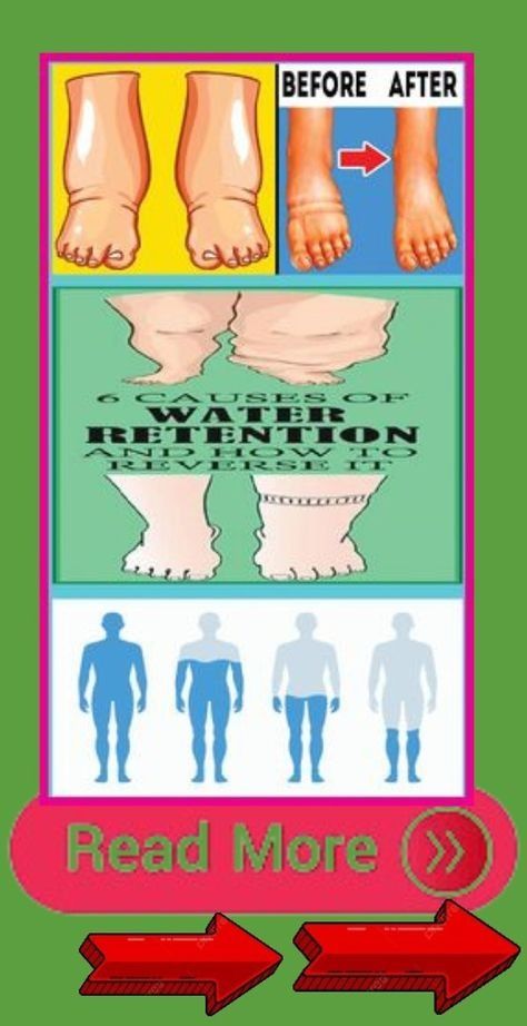 6 CAUSES OF WATER RETENTION AND HOW TO REVERSE IT