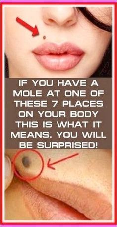 IF YOUHAVE A MOLE AT ONE OF THESE 7 PLACES ON YOUR BODYTHIS IS WHAT IT MEANS. YOU WILL BE SURPRISED!