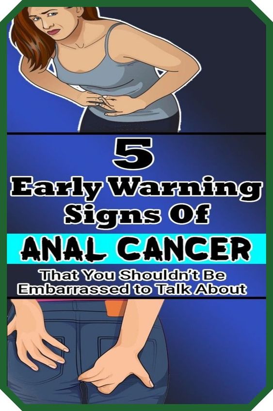 5 Early Warning Signs Of Anal Cancer That You Shouldn’t Be Embarrassed to Talk About