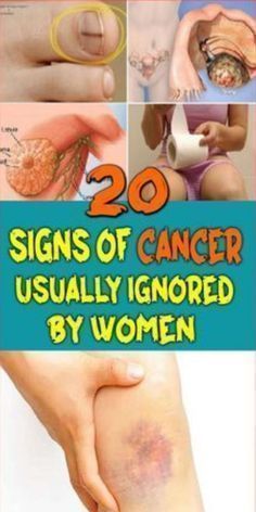 Some cancer symptoms women tend to ignore