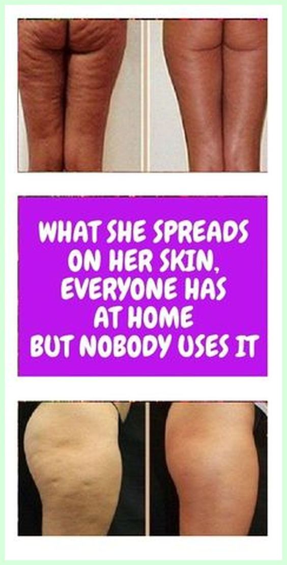 What She Spreads On Her Skin, Everyone Has at Home – But Nobody Uses It!