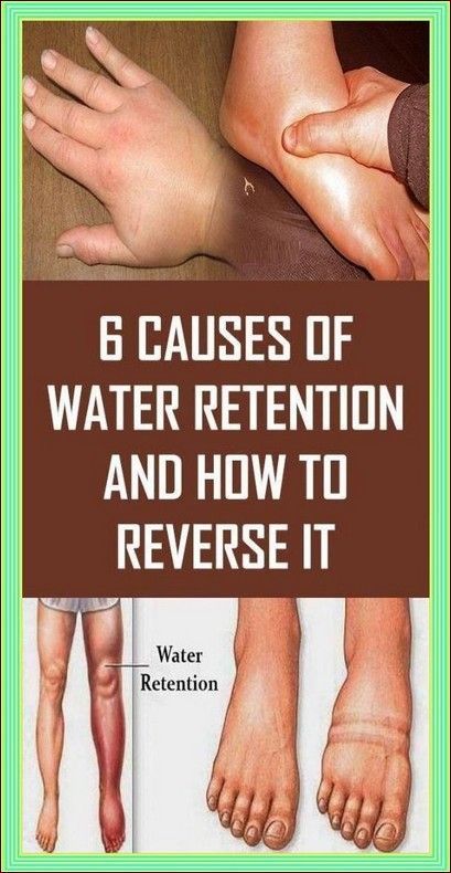 This Is How to Get Rid of Water Retention and Lose Weight Fast With This Simple Tricks and Tips!