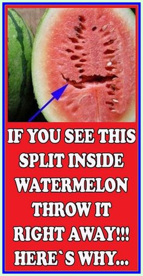 Do You Love Watermelons? If You See This Split Inside Watermelon Throw It Right Away! Here’s Why …