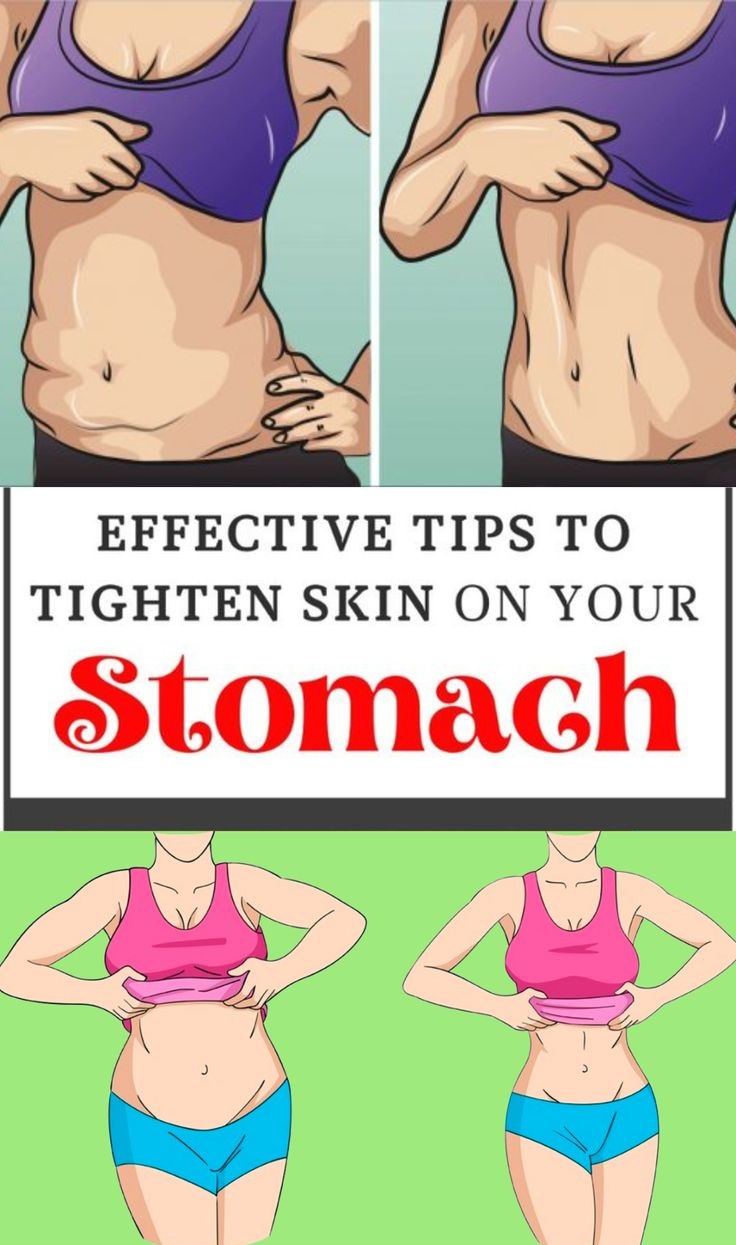 How to tighten loose skin on stomach